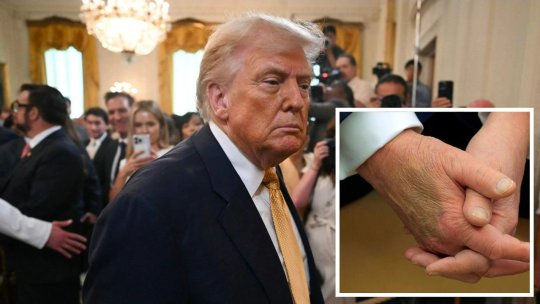 Cu ce probleme de sănătate se confruntă Donald Trump, de fapt. Casa Albă a făcut anunțul în urmă cu puțin timp