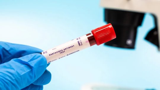 Focarul de hantavirus de pe MV Hondius continuă să se extindă. Un nou pasager a fost confirmat pozitiv în Spania