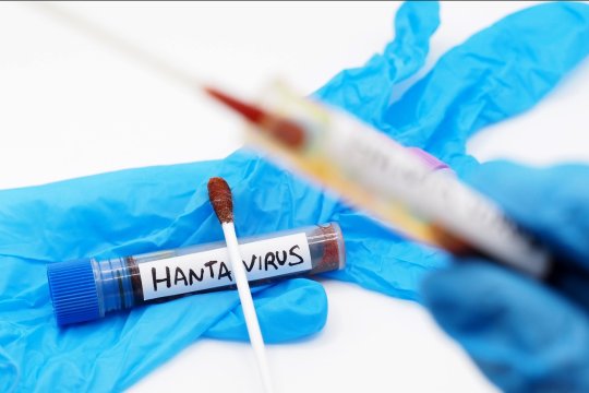 Cazul de hantavirus de la Arad a fost confirmat. Primele măsuri la Spitalul de Psihiatrie din Ștei, unde s-ar fi produs infectarea